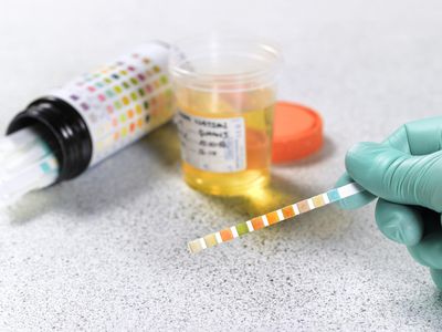 A gloved hand holding a urine test strip