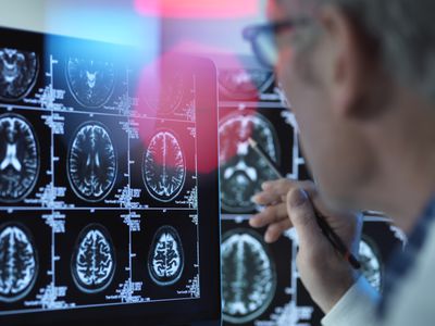 Doctor viewing brain scans in clinic.