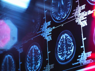 Human brain scan in a neurology clinic